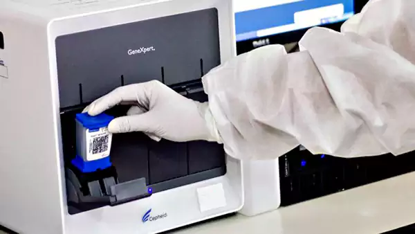 GeneXpert PCR machine