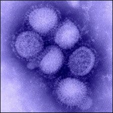 Swine Flu - H1N1 Virus Image